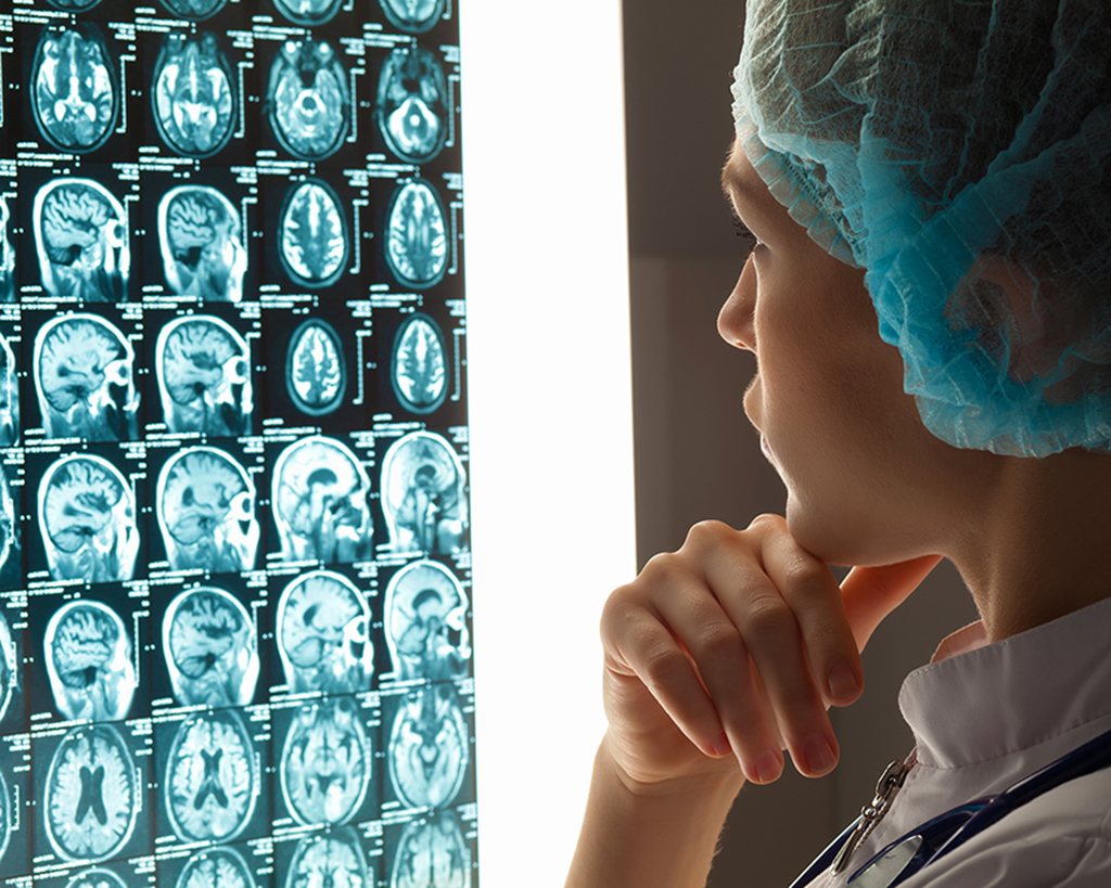 Woman doctor examining x-ray